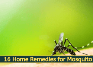16 Home Remedies for Mosquito Bites