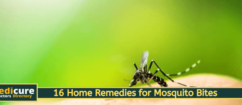 16 Home Remedies for Mosquito Bites