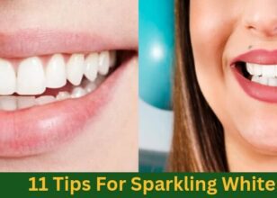 11 Tips For Sparkling White Teeth