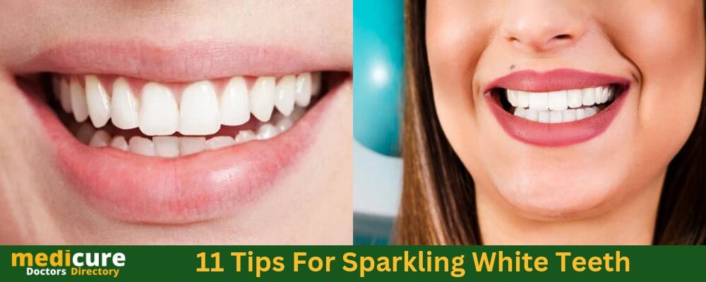 11 Tips For Sparkling White Teeth 