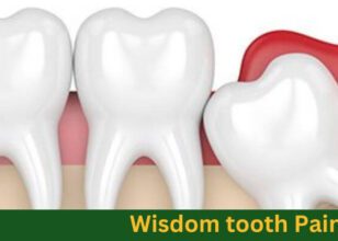 Wisdom Tooth Pain Relief and Treatment