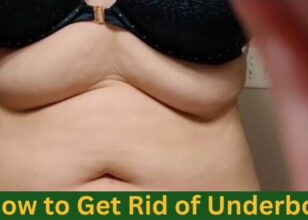 How to Get Rid of Underboob Fat?