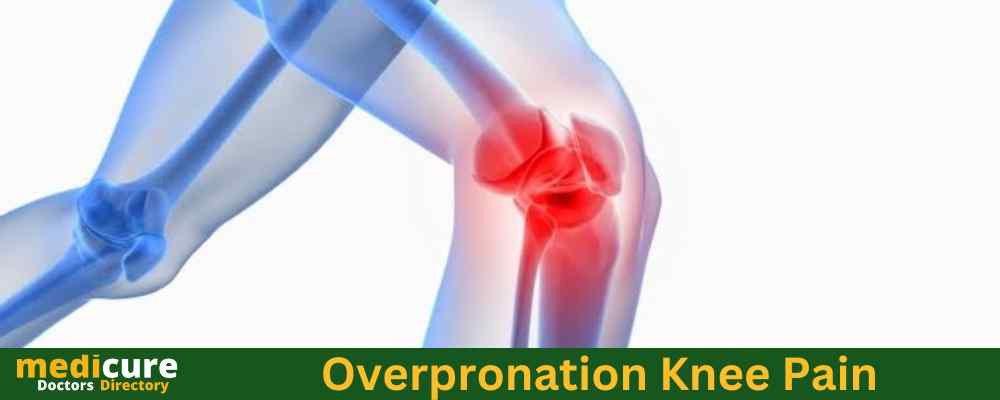 Overpronation Knee Pain – Causes & Treatment