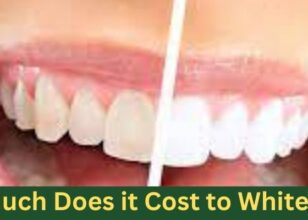 How Much Does it Cost to Whiten Teeth?