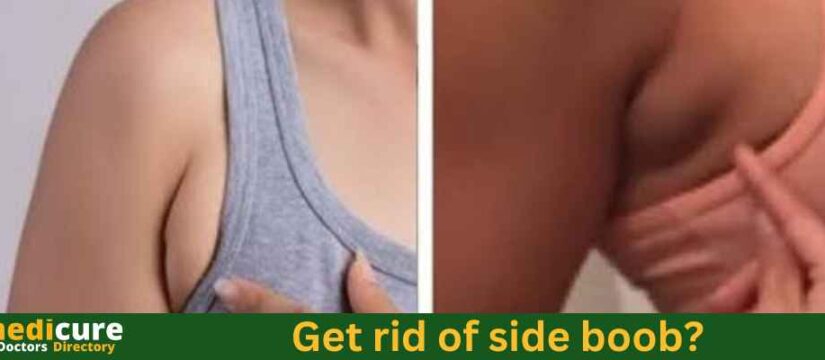 how to get rid of side boob? – Treatment