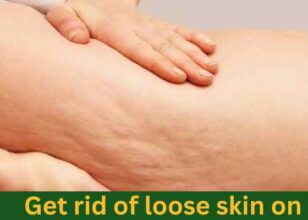 How to Tighten Loose Skin on Thighs