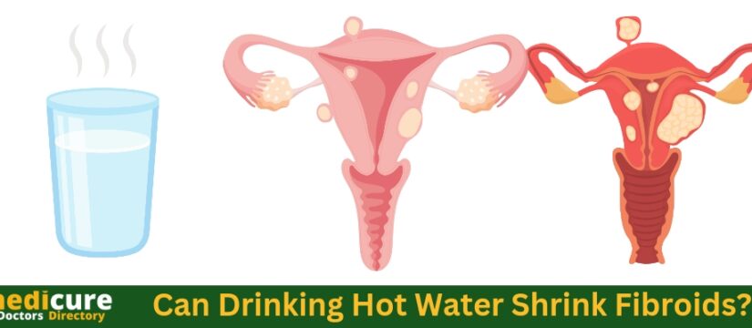 Can Drinking Hot Water Shrink Fibroids ?