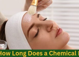 How Long Does a Chemical Peel Last ?