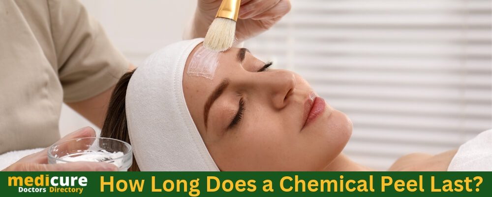 How long does a chemical peel last