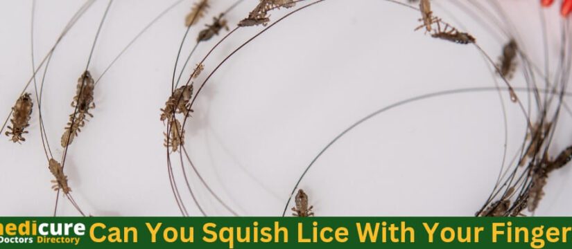Can You Squish Lice With Your Fingers?