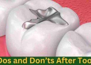Dos and Don’ts After Tooth Filling: A Comprehensive Guide