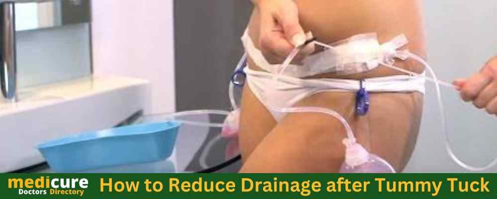How to Reduce Drainage after Tummy Tuck