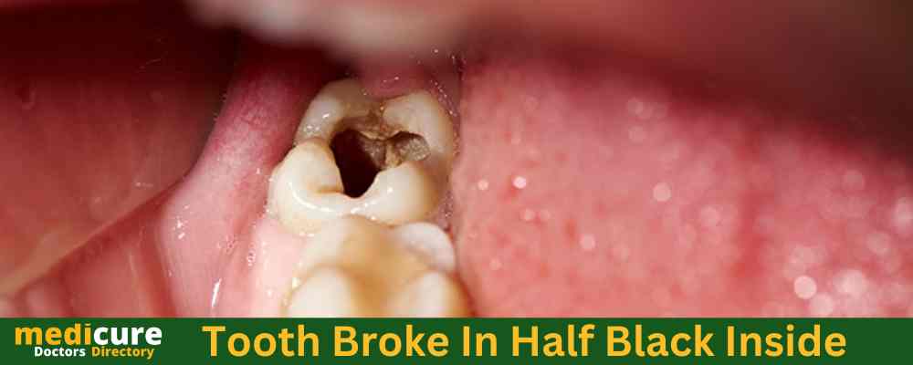 Tooth Broke In Half Black Inside