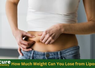 How Much Weight Can You Lose from Liposuction ?