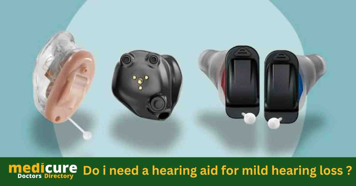 Do i need a hearing aid for mild hearing loss