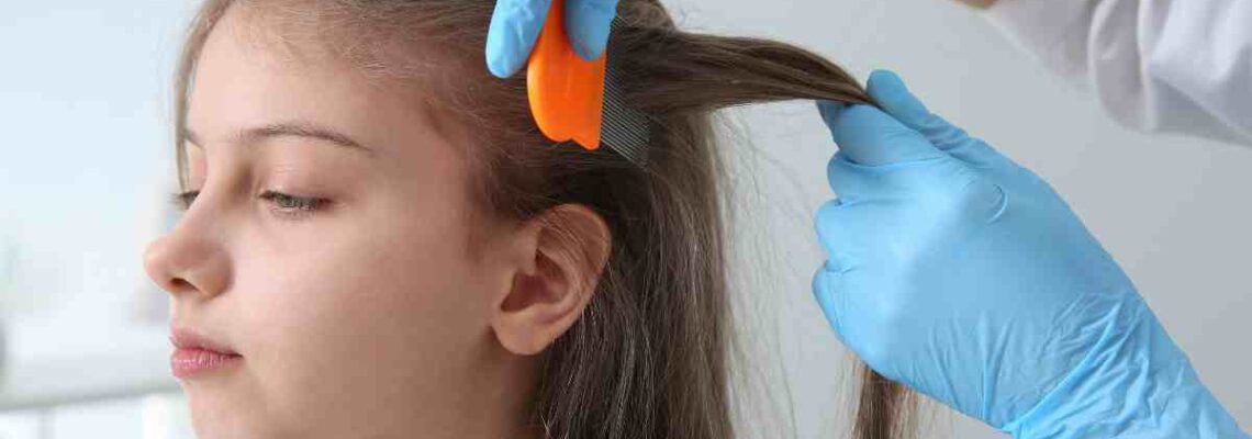 How to Calculate How Long You Have Had Lice ?
