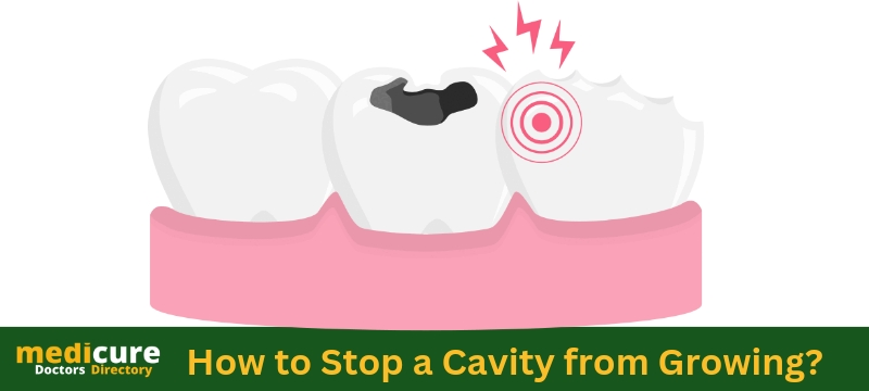 How to Stop a Cavity from Growing?