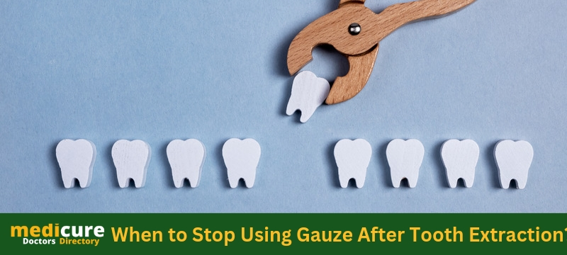 When to Stop Using Gauze After Tooth Extraction: A Comprehensive Guide