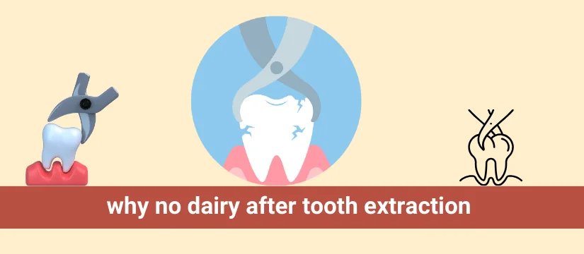why no dairy after tooth extraction
