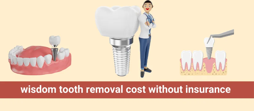 wisdom tooth removal cost without insurance