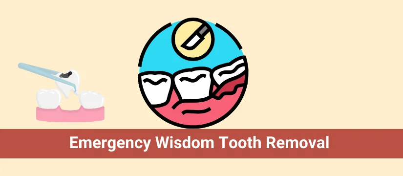 Emergency Wisdom Tooth Removal